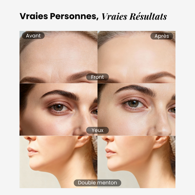 éline™ - Brosse Drainage Lymphatique Visage