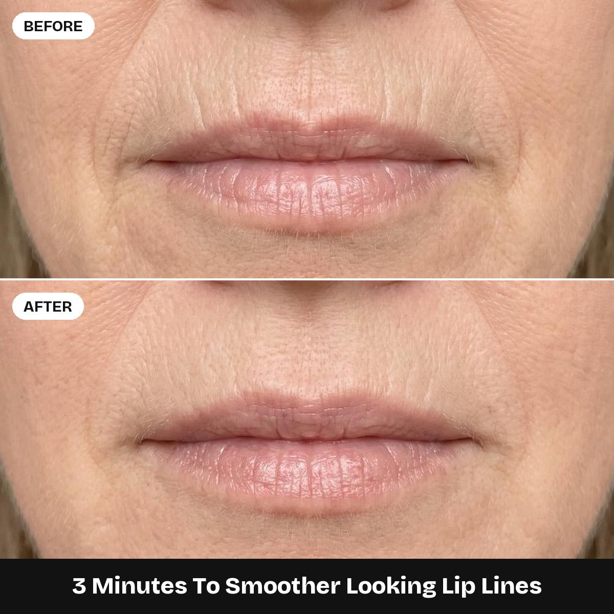 Lip lines before and after, 3 minutes apart (illustration)